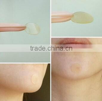 HDT invisibility Hydrocolloid Acne plaster