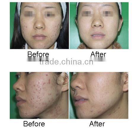 Big Discount Sale Skin Rejuvenation Oxygen Jet Peel Machine Oxygen Therapy Facial Machine Oxygen Facial Machine