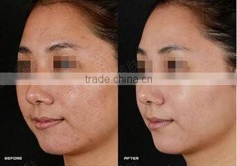 Hot Korea new product led mask 7 colors led skin rejuvenator mask for clinic or salon use