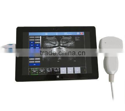 UProbe-20 Probe Type Ultrasound Scanner for laptop