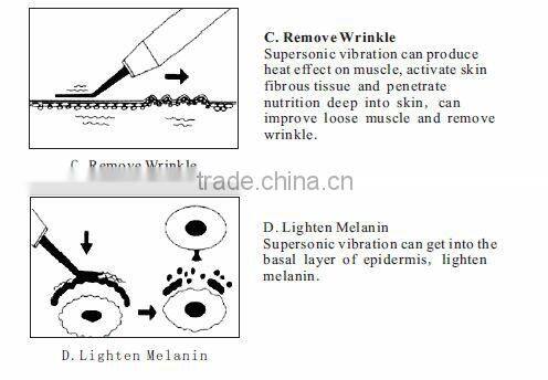 Quality assured Facial Cleaner Face Care Spa Skin Massager Scrubber Deep Clean Beauty