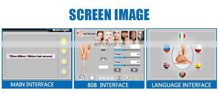 2000w power macro-channel milesman diode laser hair removal machine