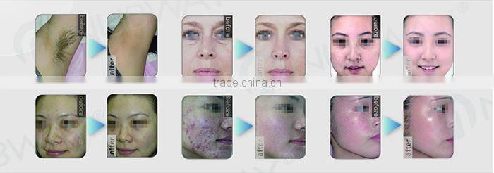 Portable IPL & SHR & E-light & OPT hair removal beauty equipment & machine for wrinkle removal acne treatment