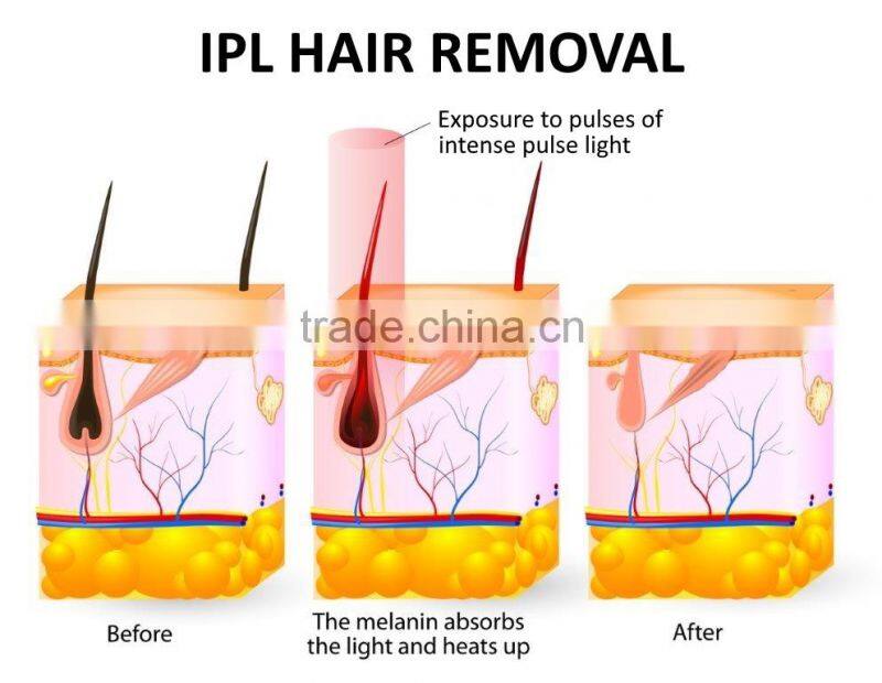 Hot sale! The newest ipl hair removal machine for home use