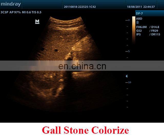 DP-7 Factory Price Mindray trolley Full digital DP-7 ultrasound machine price