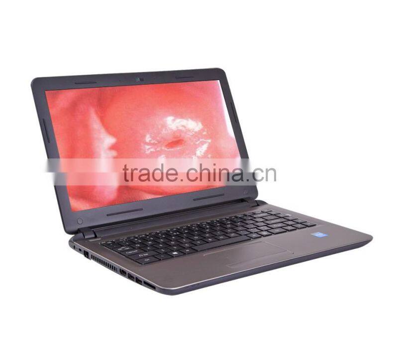 Portable Digital Electronic Colposcope in cheap price