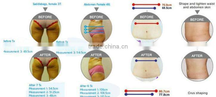 Ultrasonic cavitation slimming machine / RF liposuction Vacuum Machine With 4 Probes