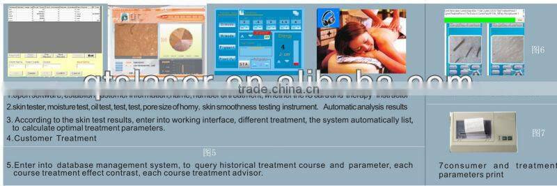 Multi-Function Beauty Equipment 4 in 1 E Light/ IPL RF/ Laser/Skin Analyzer