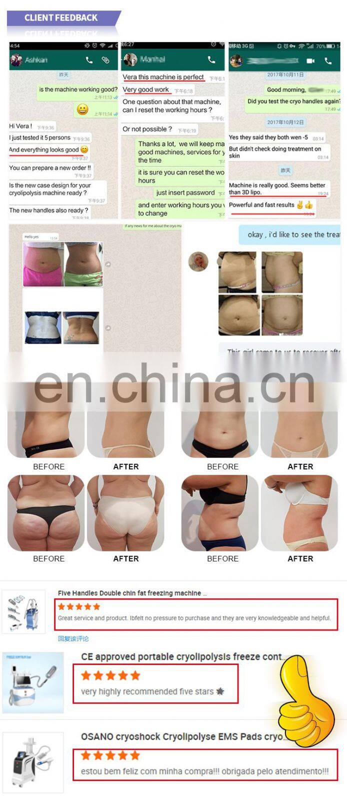 Lipo laser radio frequency cavitation rf vacuum body fat loss machine