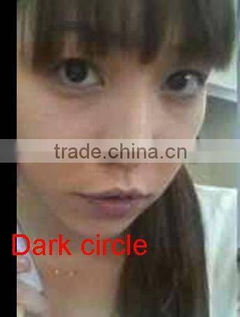 eye bag-dark circle -skin lifting around eyes -eye care system