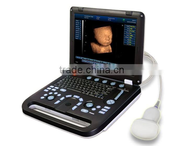 MCB-E5B 15in LCD Digital Laptop Ultrasound Scanner