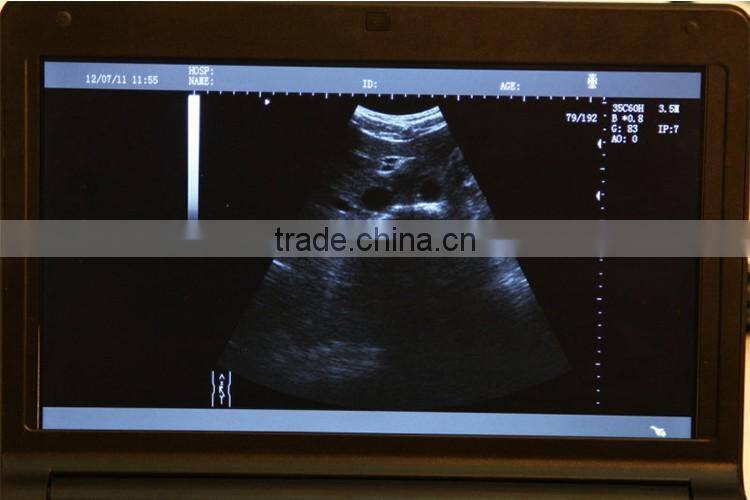 Cheap price CE Approved Hospital Diagnose Probe/Transducer laptop portable ultrasound scan machine