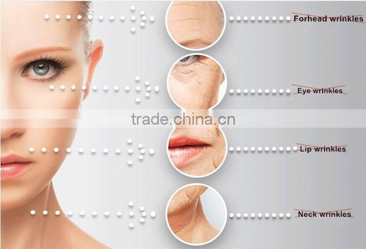 2017 Hot sale home use New Mini Hifu machine anti-wrink skin tightening wrinkle removerfor beauty