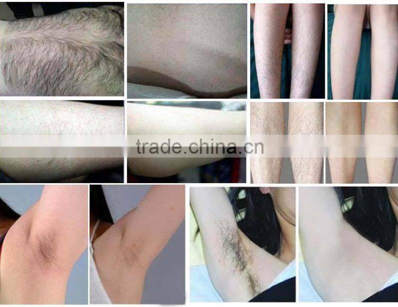 Promotion!! opt ipl shr hair for 2 in 1 shr hair removal IPL SHR skin rejuvenation