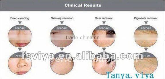 VY-909 Almighty Oxygen Skin Rejuvenation Beauty Device With Diamond Dermabrasion