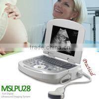 Coupon available! Ipad ultrasound scanner, touch screen scanner 3D color doppler MSLCU22-N