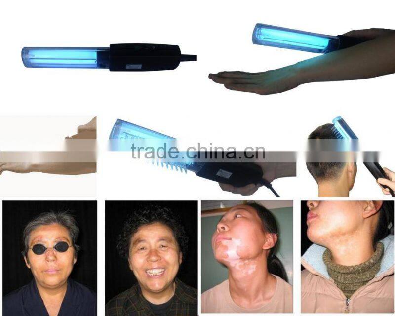 DermaPro handheld UV-B Phototherapy Lamp for skin disorder treatment