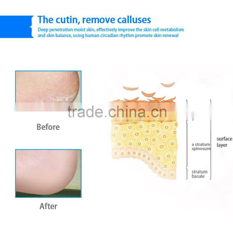 Silicone Heel Protectors for woman ,ankle protector foot care