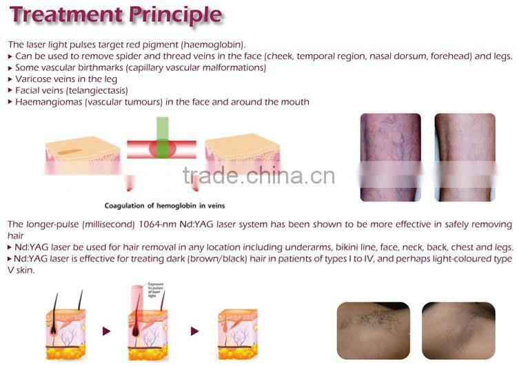 Good effects closed-off water circulation + air cooling system nd yag laser for tattoo removal