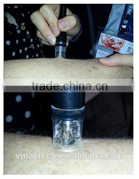 Factory hydra microdermabrasion peel spa facial machine / hydro microdermabrasion facial machine / water dermabrasion SPA9.0