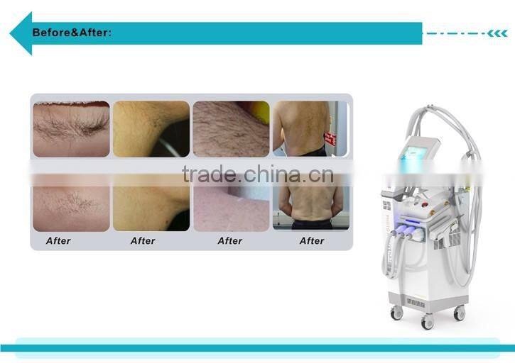 Portable IPL machine/hair removal skin rejuvenation/spot removal wrinkle removal machine --EPL400