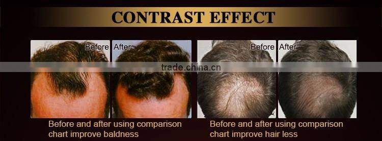 CE,RoHS certified hair strength hair loss treatment machine hair care comb head massager beauty product