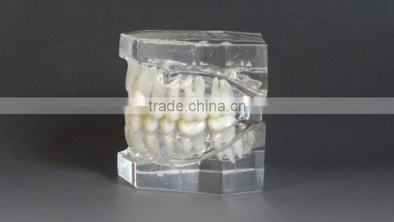 Malocclusion Classification Demonstration Model 1