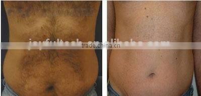 808nm diode laser high voltage power supply hair removal machine