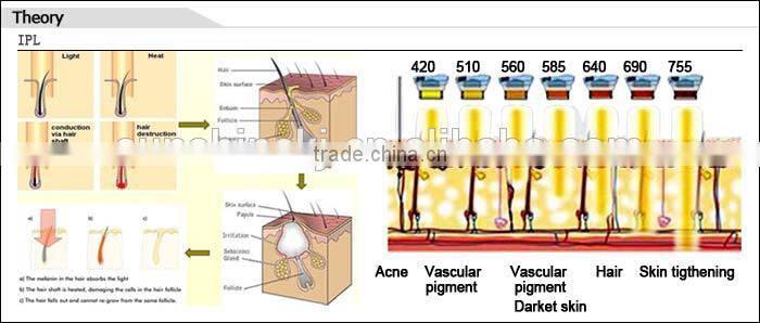 3000W high power hair removal/skin rejuvenation/wrinkle removal home use ipl laser machine