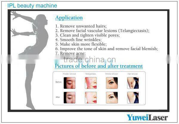 Salon Use Spa SHR IPL Hair Removal Elight Machine