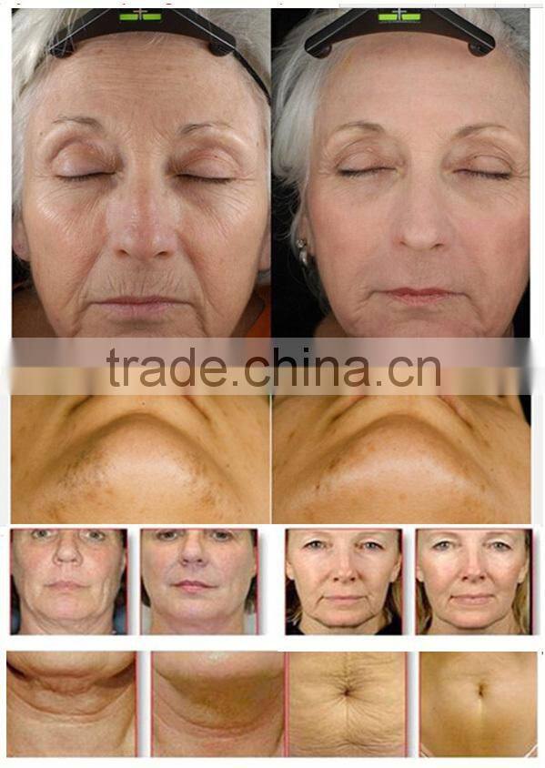 Beauty equipment guanzhou bio lifting face machine cavisculpt equipment