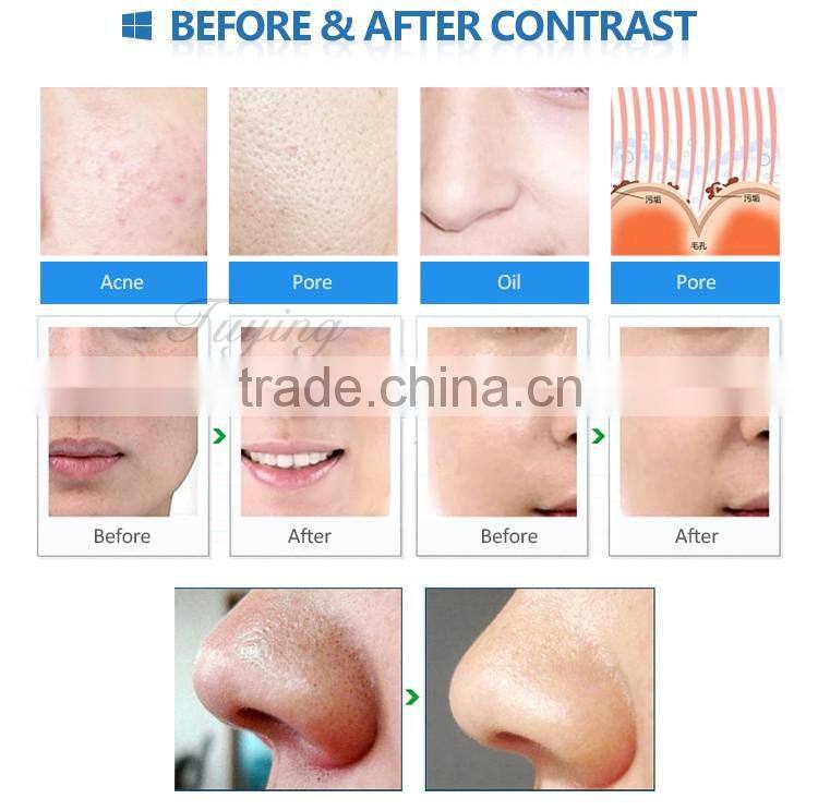 Handle portable facial beauty diamond dermabrasion machine with price