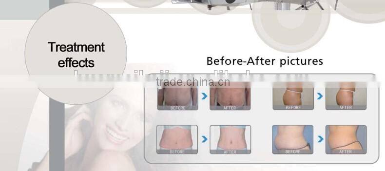 CE approved lipolaser