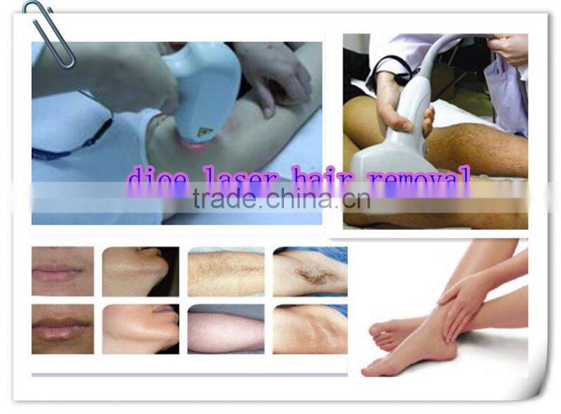Professional 808nm laser diode hair removal germany