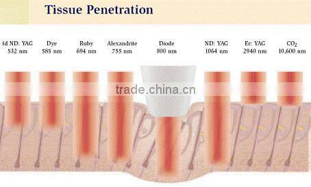 Beauty Equipment diode laser 808 from china supplier