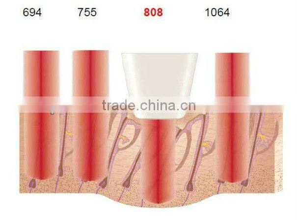 2013 Most advanced technology 808nm diode laser for hair removal machine