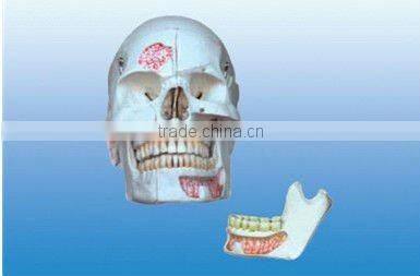 Skull model of head