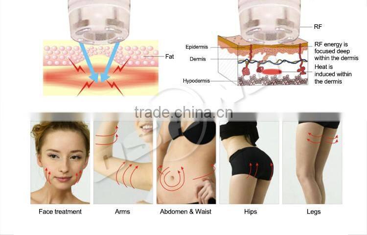 Portable RF Skin Tightening RF Slimming Machine