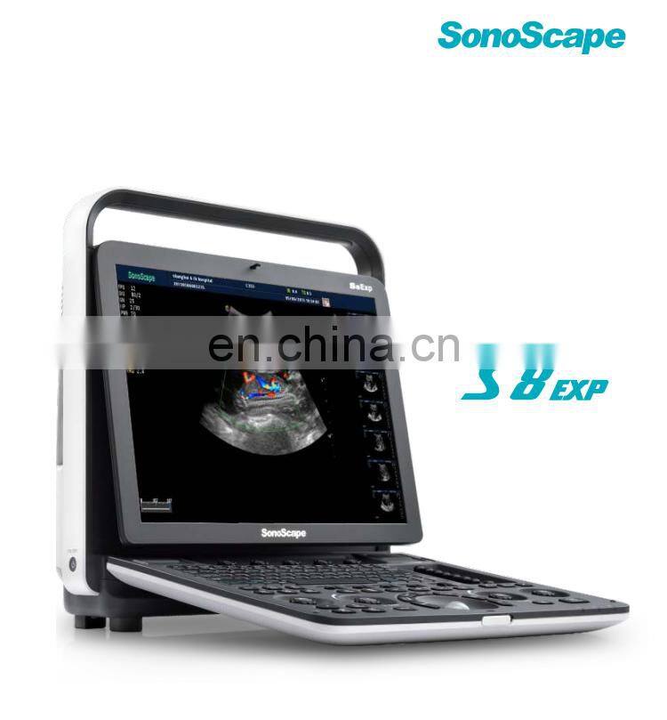 Professional 4D Color Doppler Sonoscape ultrasound scanner/Portable Sonoscape S8 EXP/Sonoscape ultrasound