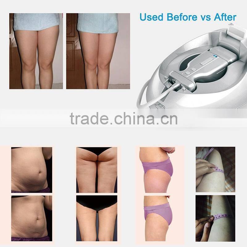 2017 mini liposonix transducer machine for body slimming portable home use weight loss machine