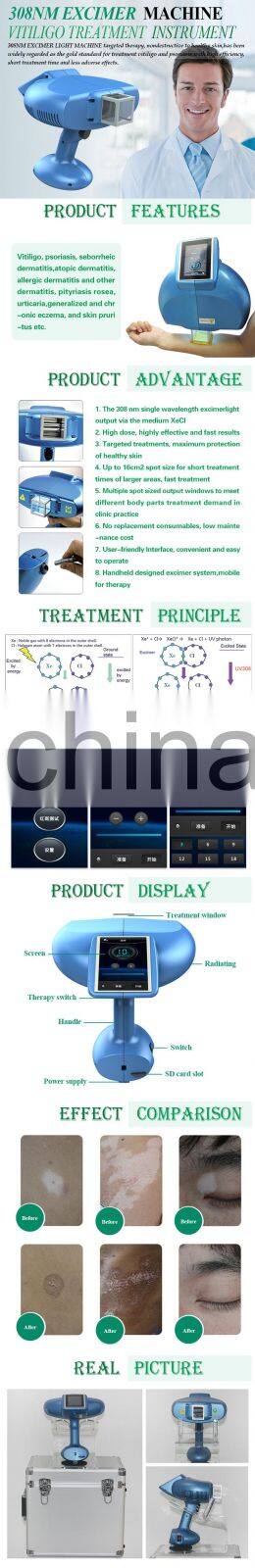Professional clinic use 308nm excimer laser machine for vitiligo treatment