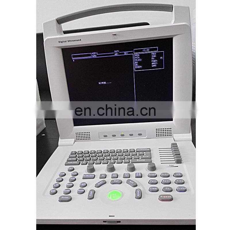 HC-A004 good quality mobile phone ultrasound scanner Digital portable ultrasound pregnancy scanner machine price