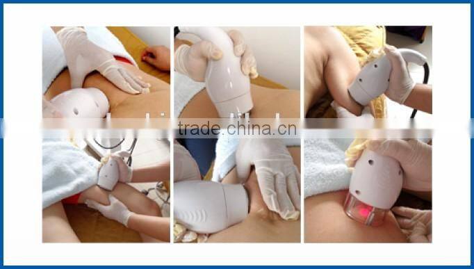 Loss weight vacuum cavitation for top sale