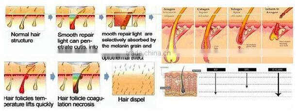 2015 Top sale promotion fast permanently hair removal instrument ipl shr FDA Approval