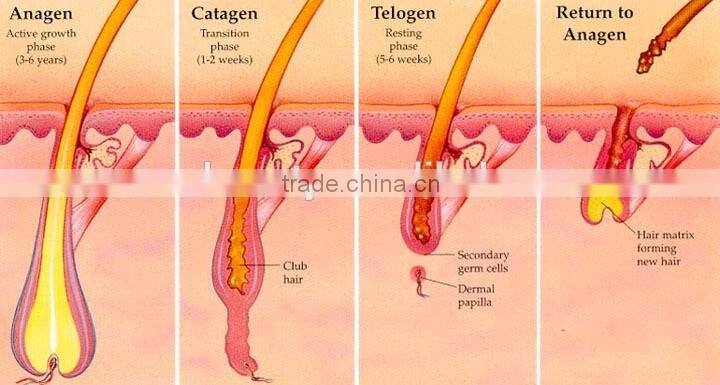 20% discount portable ipl equipment for hair removal with medical ce