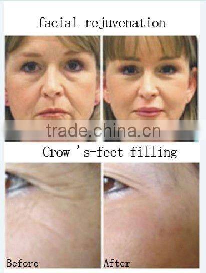 oxygen jet beauty instrument