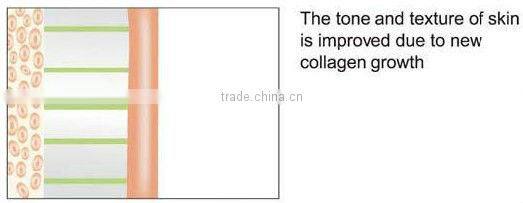 hm-rf-a100 monopolar