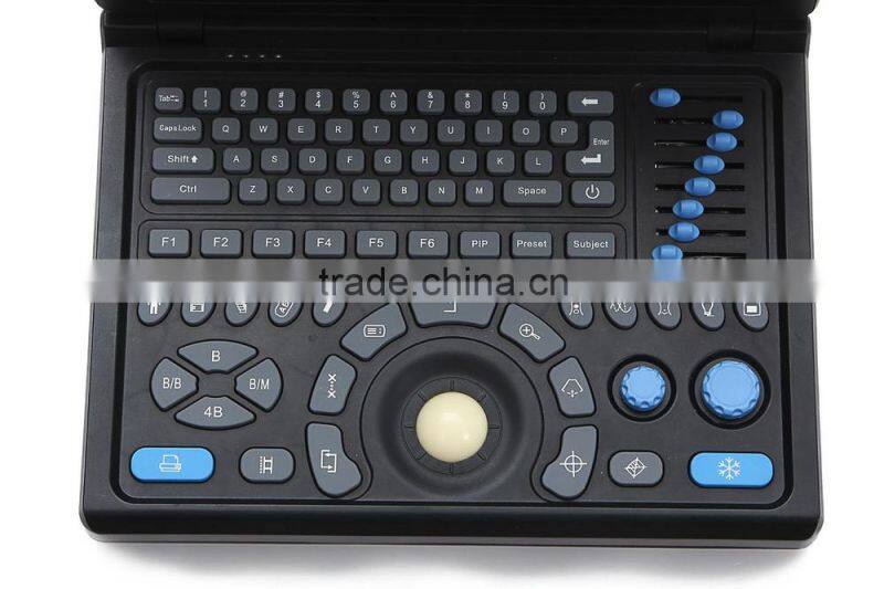 Good Image Portable/Notebook/Laptop RUS-9000E2 ultrasound Scanner/machine with convex probe, linear, vaginal, rectal transducer