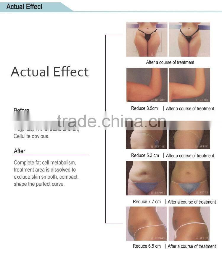 2016 Best selling focused ultrasound salon use machine for women body shape