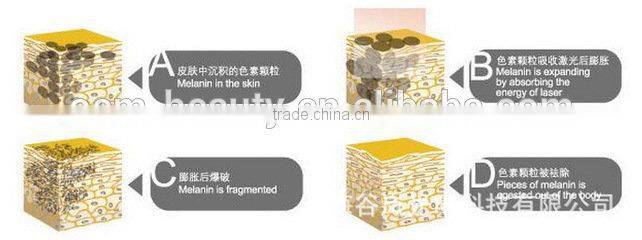 the excellent beauty machine Nd.Yag Laser tattoo removal for sale